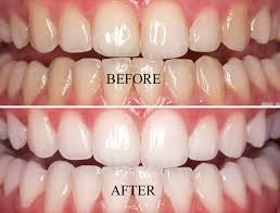 SHIFA Speciality Dental Clinic KODUVALLY